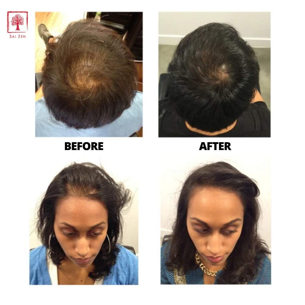 Sai Zen Anti-Aging Volume Conditioner | Anti-Thinning and Volumizing Formula | Made in USA | Sulfate and Paraben Free | All Hair Types, 8 oz.