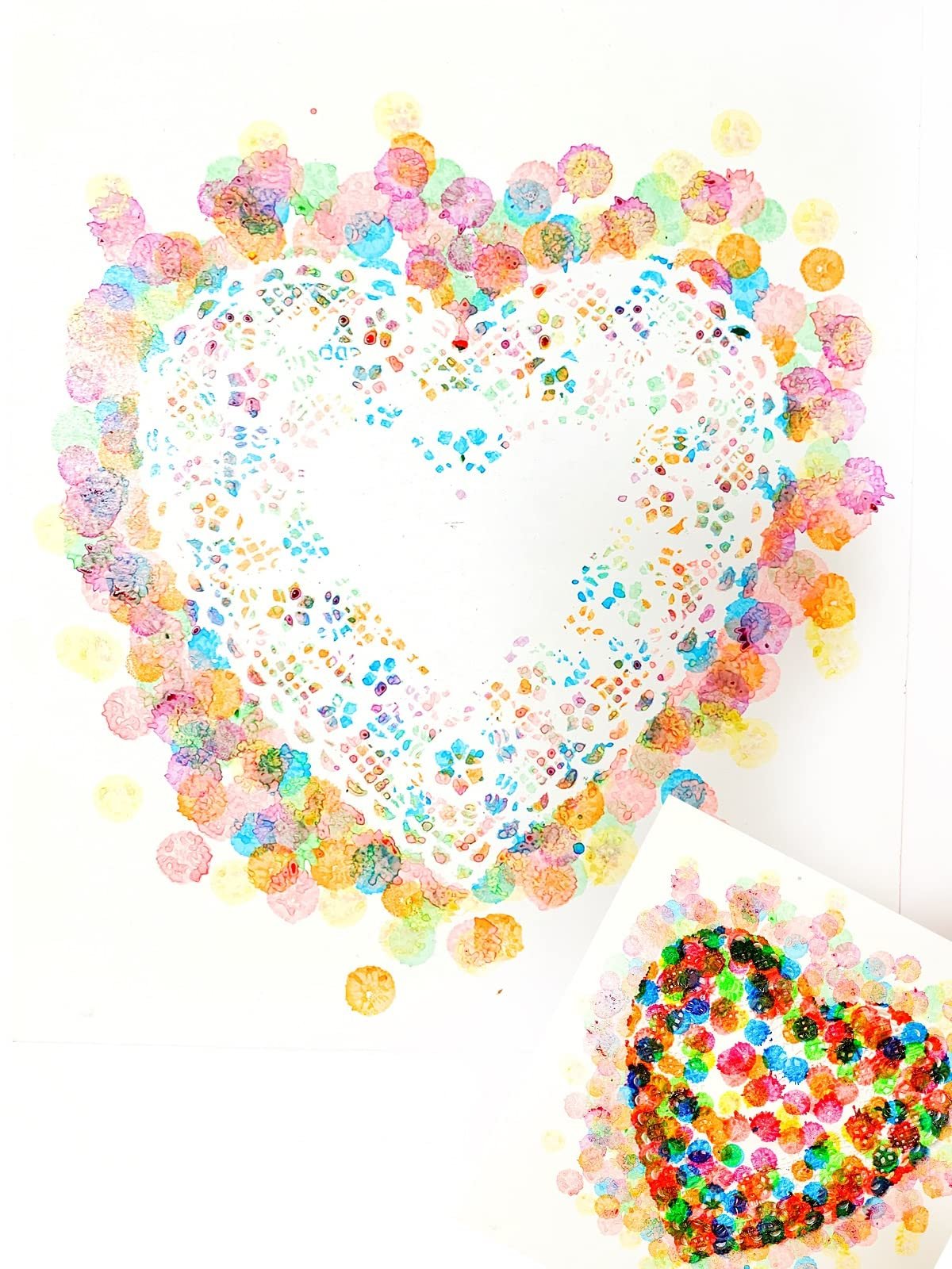 Hygloss Round Paper Doilies - 100 Pcs. 10-Inch - Decorative White Lace Doilies - Disposable and Food Grade Safe